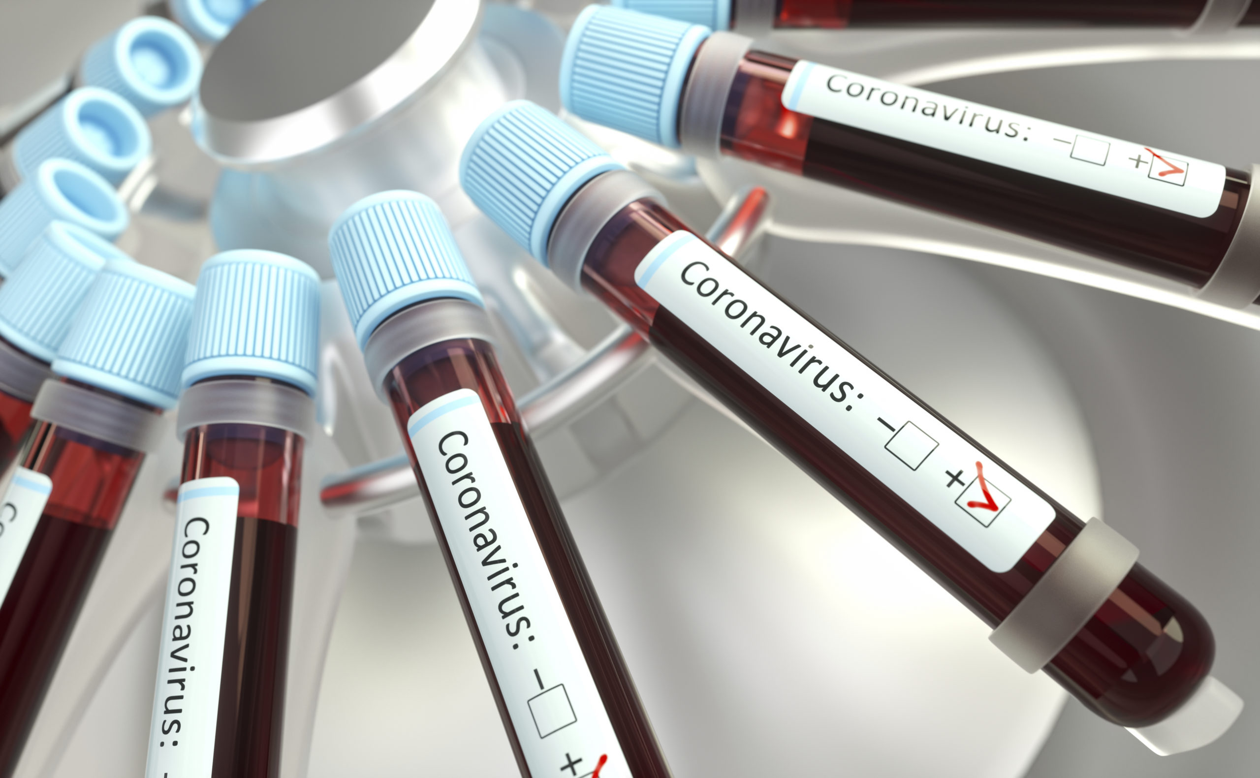 Trump: Rapid Coronavirus Test Coming
